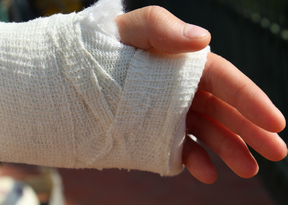 Most injuries are to the extremities